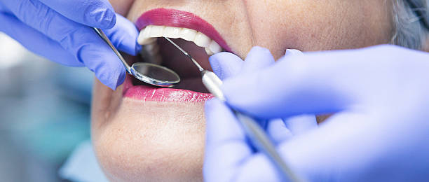 Best Emergency Treatment for Oral Infections in Mford, IL